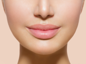 A Fuller, More Youthful Appearance Can Be Achieved With Lip Augmentation