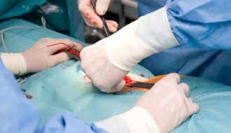 Hernia Surgery